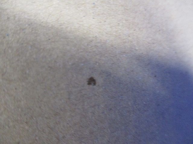 LEDダウンライト LEDD-183205-LS9+LEEU-1503WW-02 LEKD1533215WW-LS9